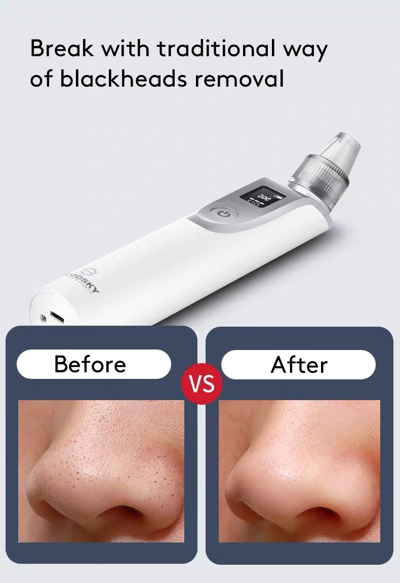 USB Charging Facial Blackhead Remover