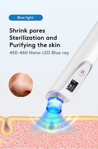 USB Charging Facial Blackhead Remover